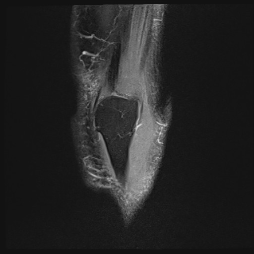 Click on the Serie image to view the images of Wieszt, Gnter